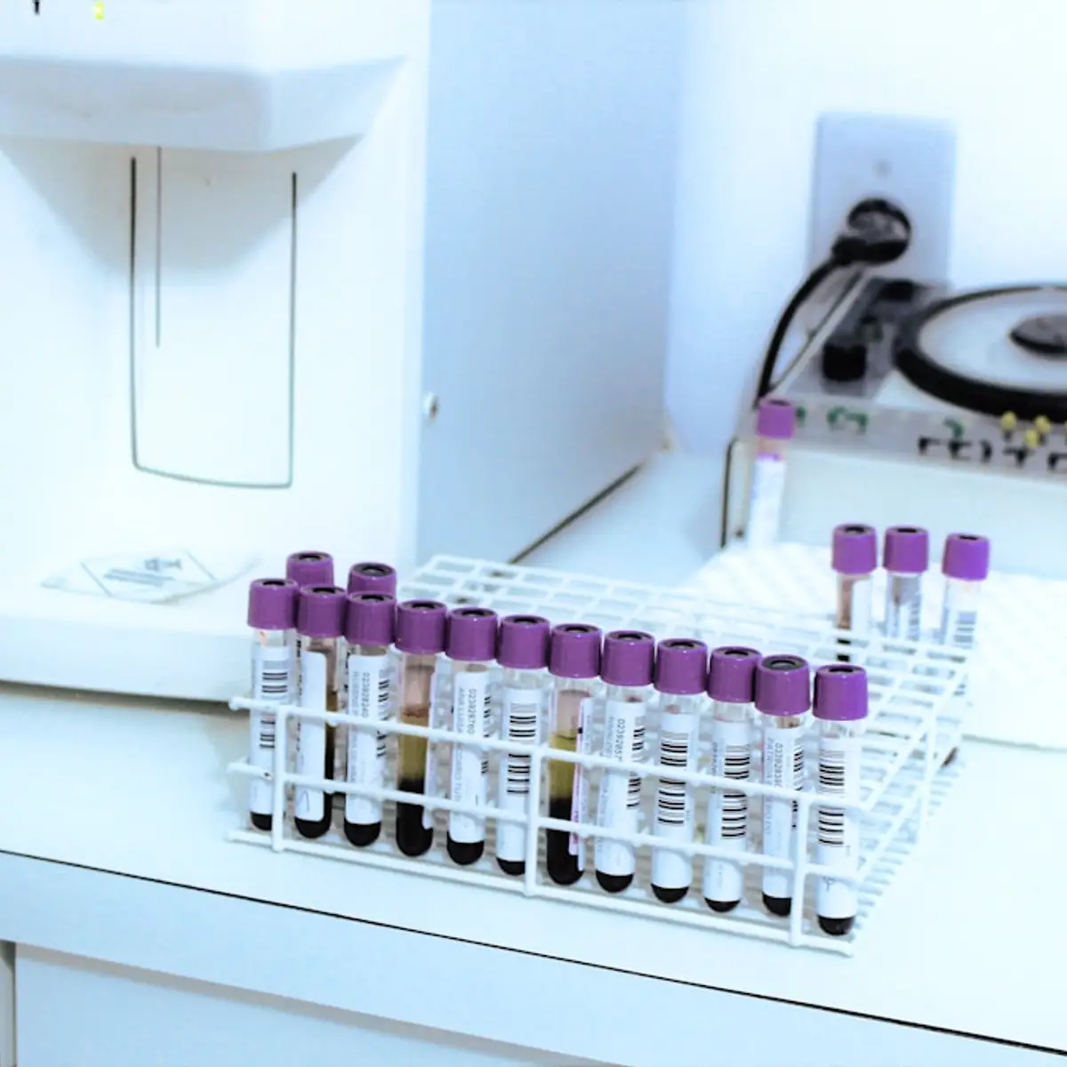 A bench analyser beside a rack of purple-capped EDTA sample tubes.