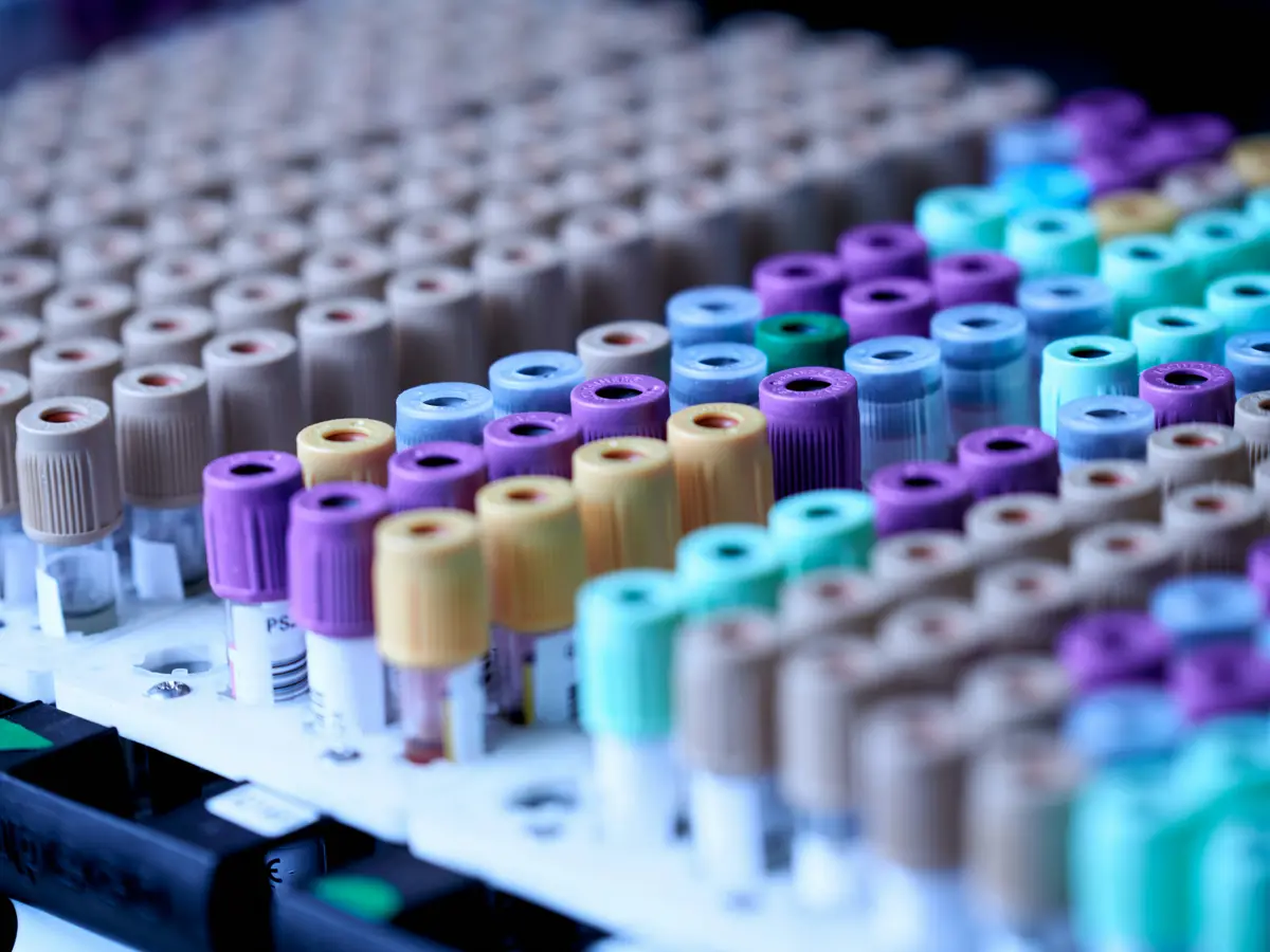 Racks of colour-capped blood collection tubes, sealed and labelled.