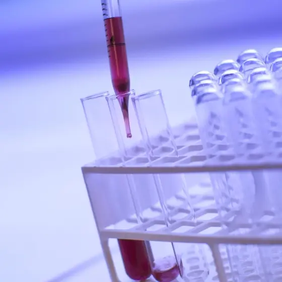 A pipette dispensing a blood sample into a rack of glass test tubes.