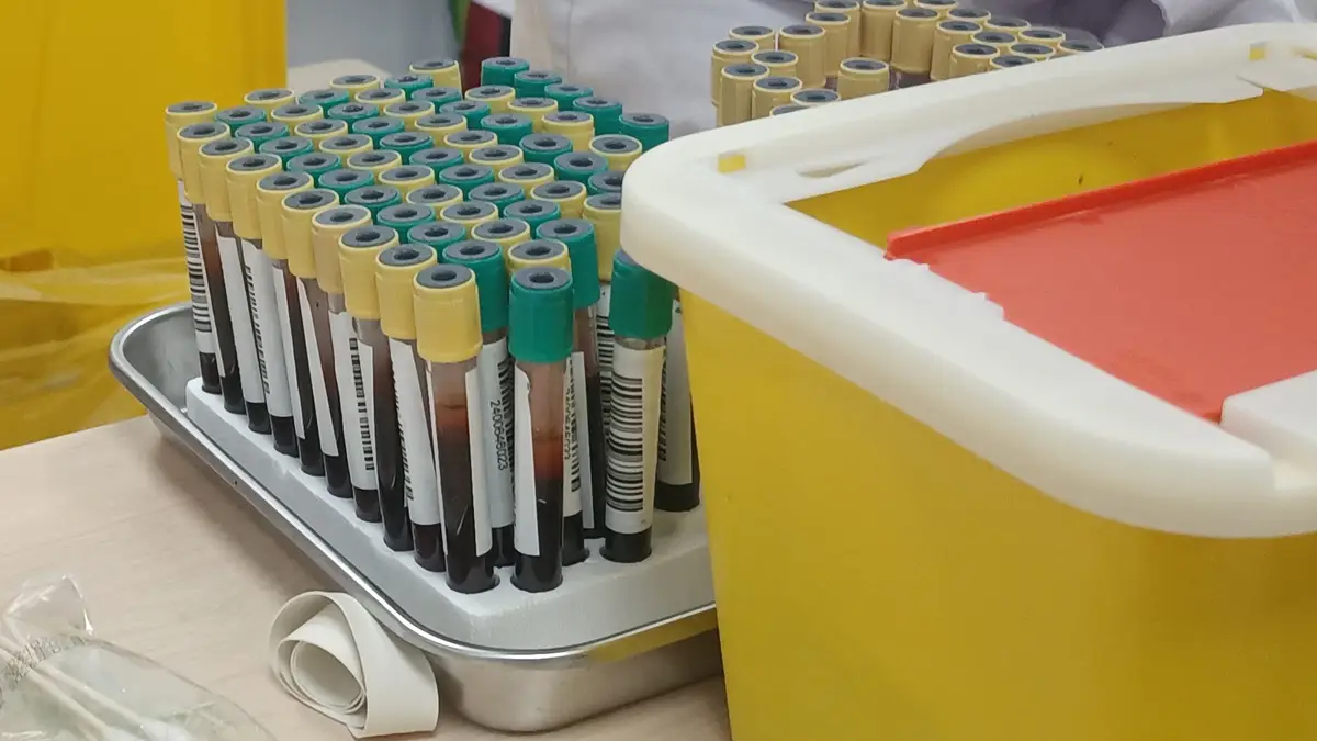 A full rack of labelled blood sample tubes on a laboratory bench beside a sharps container.